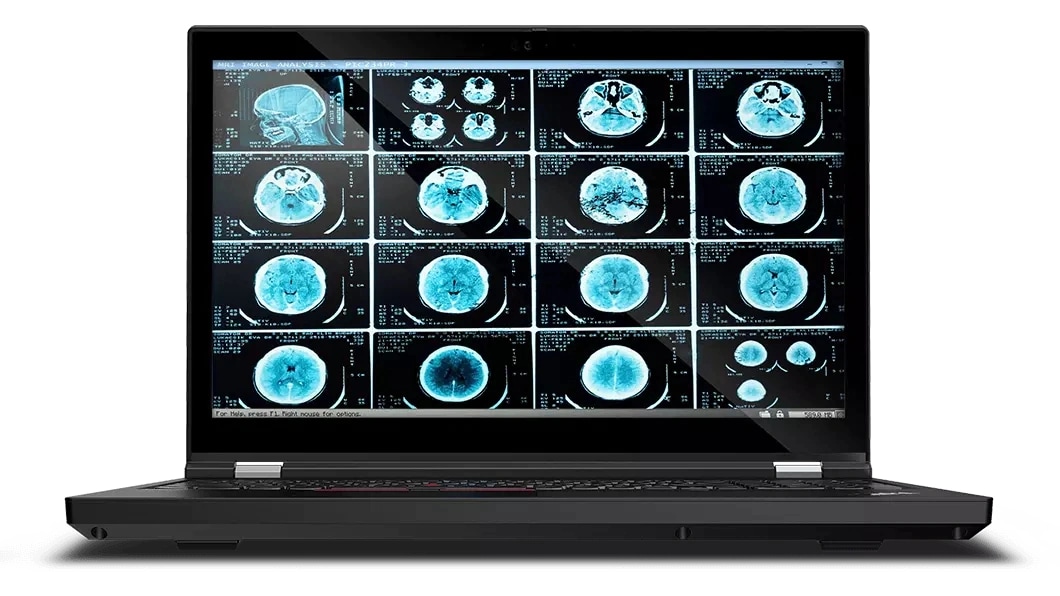 Vue avant du portable Lenovo ThinkPad T15g Gen 2 et de l’écran affichant des images de scanner cérébral via un logiciel médical.